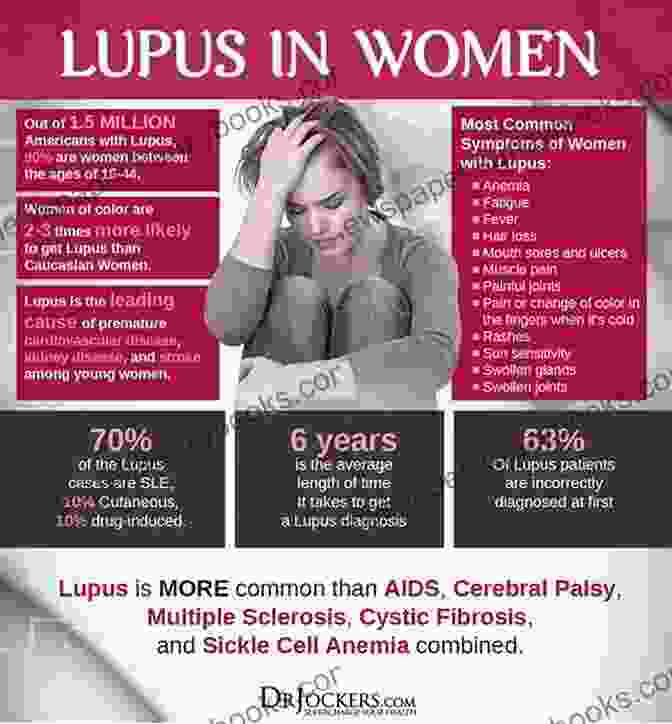 A Woman Living With Lupus, Showcasing Resilience Lupus In Spite Of The Wolf