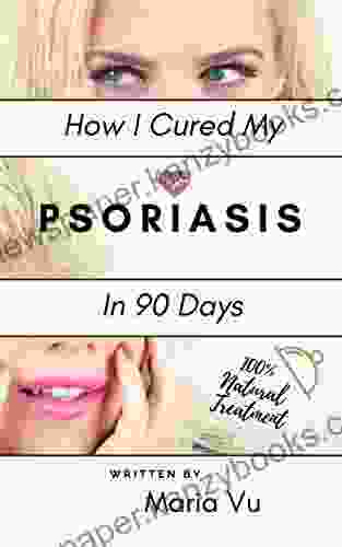 How I Cured My PSORIASIS In 90 Days : 100% Natural Treatment